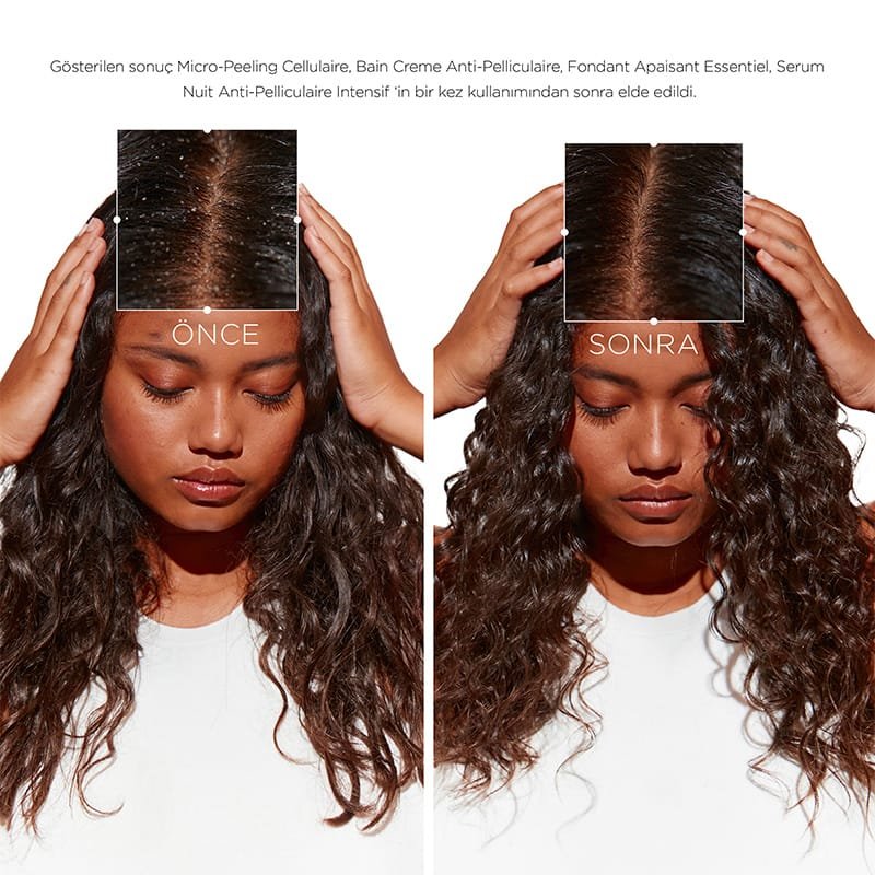 Symbiose Before After 1